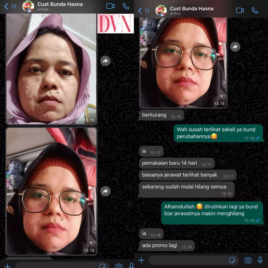 DVN testimoni