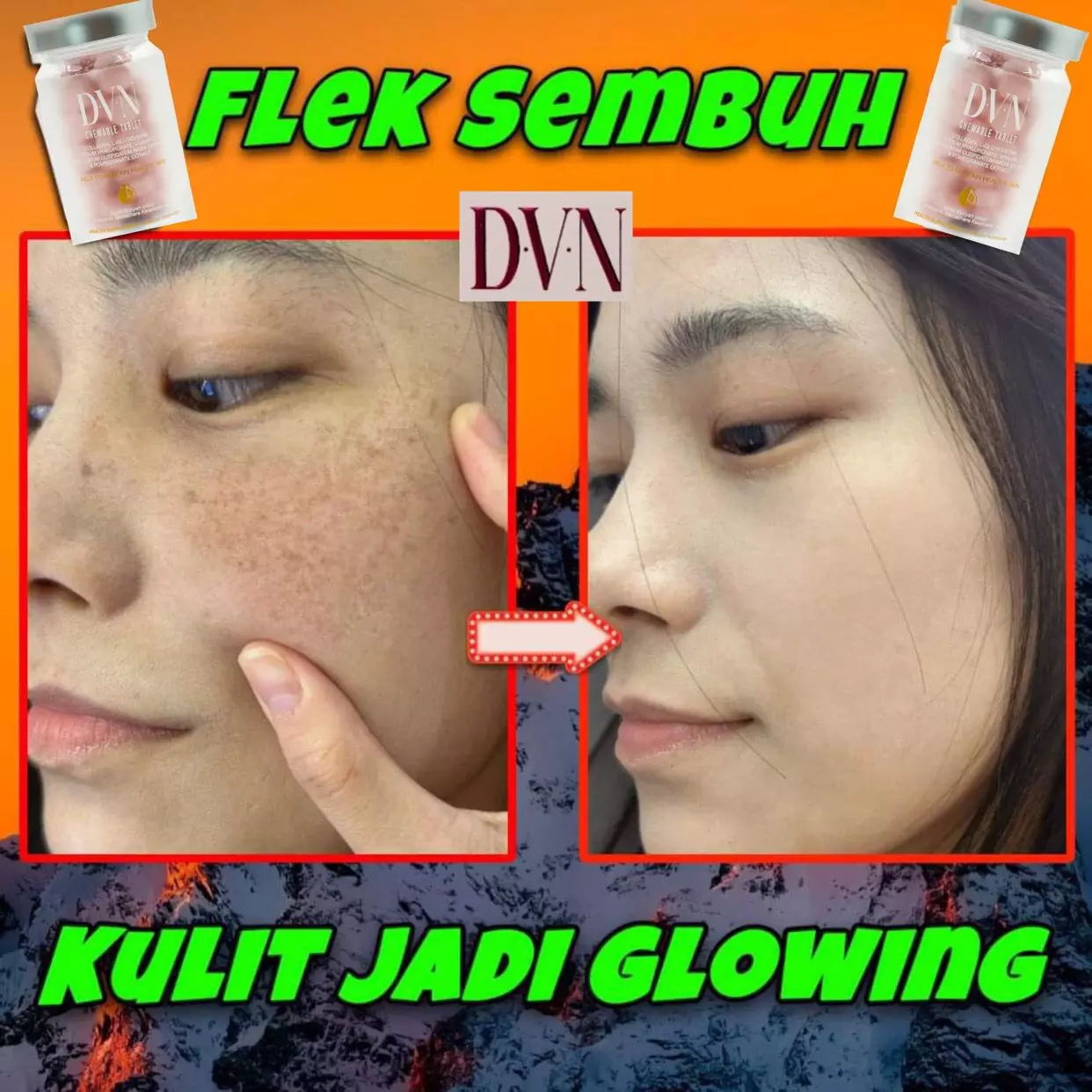 DVN testimoni